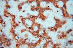FGL1 Rabbit anti-Human, Mouse, Rat, Polyclonal, Proteintech 150 &mu;L;