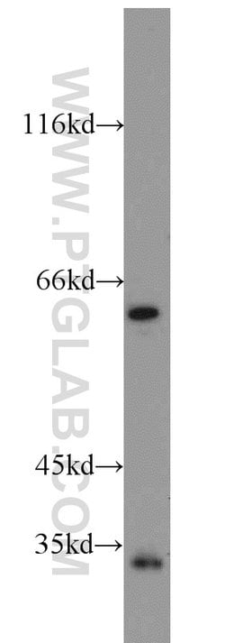 FGL1 Rabbit anti-Human, Mouse, Rat, Polyclonal, Proteintech 150 &mu;L;