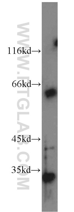 FGL1 Rabbit anti-Human, Mouse, Rat, Polyclonal, Proteintech 150 &mu;L;