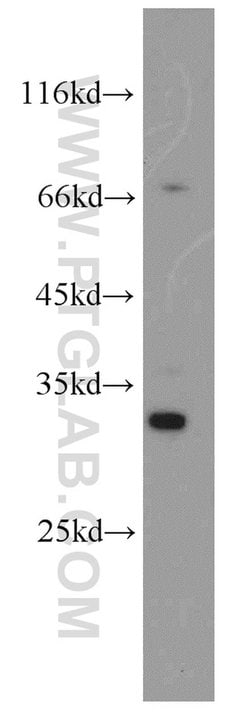 FGL1 Rabbit anti-Human, Mouse, Rat, Polyclonal, Proteintech 150 &mu;L;
