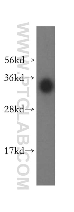 FGL1 Rabbit anti-Human, Mouse, Rat, Polyclonal, Proteintech 150 &mu;L;