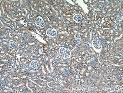 ARG1 Rabbit anti-Human, Mouse, Rat, Polyclonal, Proteintech 150 &mu;L;