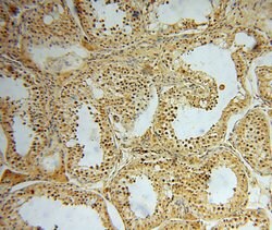 ARG1 Rabbit anti-Human, Mouse, Rat, Polyclonal, Proteintech 150 &mu;L;