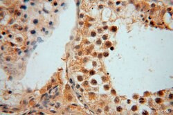 ARG1 Rabbit anti-Human, Mouse, Rat, Polyclonal, Proteintech 150 &mu;L;