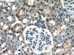 ARG1 Rabbit anti-Human, Mouse, Rat, Polyclonal, Proteintech 150 &mu;L;