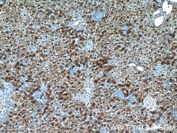 ARG1 Rabbit anti-Human, Mouse, Rat, Polyclonal, Proteintech 150 &mu;L;
