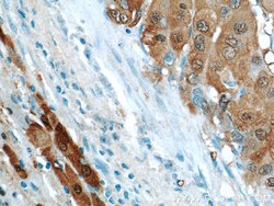 ARG1 Rabbit anti-Human, Mouse, Rat, Polyclonal, Proteintech 150 &mu;L;