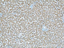ARG1 Rabbit anti-Human, Mouse, Rat, Polyclonal, Proteintech 150 &mu;L;