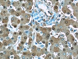 ARG1 Rabbit anti-Human, Mouse, Rat, Polyclonal, Proteintech 150 &mu;L;