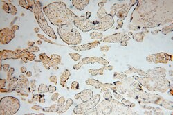 ARG1 Rabbit anti-Human, Mouse, Rat, Polyclonal, Proteintech 150 &mu;L;