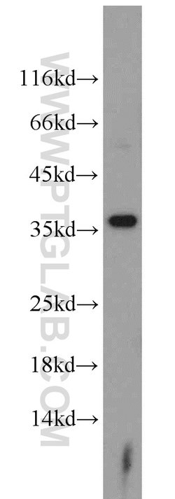 ARG1 Rabbit anti-Human, Mouse, Rat, Polyclonal, Proteintech 150 &mu;L;