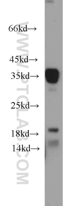 ARG1 Rabbit anti-Human, Mouse, Rat, Polyclonal, Proteintech 150 &mu;L;
