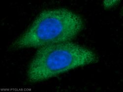 ARG1 Rabbit anti-Human, Mouse, Rat, Polyclonal, Proteintech 150 &mu;L;
