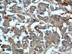 ARG1 Rabbit anti-Human, Mouse, Rat, Polyclonal, Proteintech 150 &mu;L;