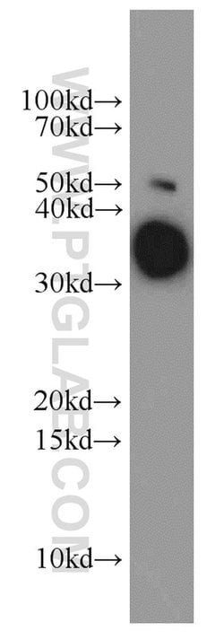 ARG1 Rabbit anti-Human, Mouse, Rat, Polyclonal, Proteintech 150 &mu;L;