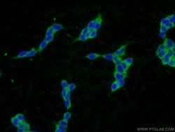 PLA2G12A Rabbit anti-Human, Mouse, Rat, Polyclonal, Proteintech 150 &mu;L;