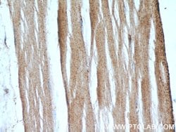 PLA2G12A Rabbit anti-Human, Mouse, Rat, Polyclonal, Proteintech 150 &mu;L;