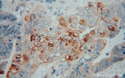 PLA2G12A Rabbit anti-Human, Mouse, Rat, Polyclonal, Proteintech 150 &mu;L;
