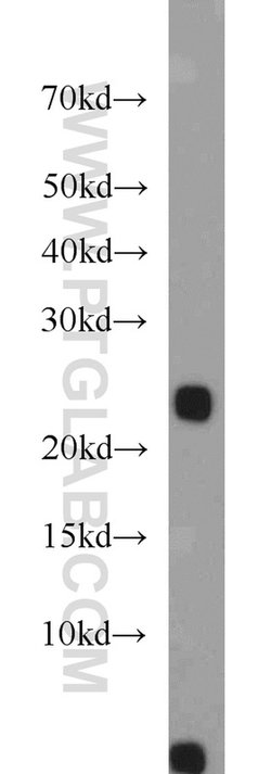 PLA2G12A Rabbit anti-Human, Mouse, Rat, Polyclonal, Proteintech 150 &mu;L;