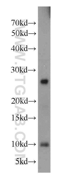 PLA2G12A Rabbit anti-Human, Mouse, Rat, Polyclonal, Proteintech 150 &mu;L;