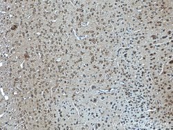 CYFIP1/2 Rabbit anti-Human, Mouse, Polyclonal, Proteintech 20 &mu;L; Unconjugated:Antibodies,