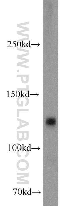CYFIP1/2 Rabbit anti-Human, Mouse, Polyclonal, Proteintech 20 &mu;L; Unconjugated:Antibodies,