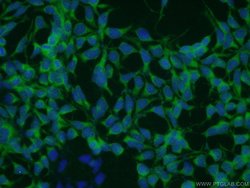 TRAPPC9 Rabbit anti-Human, Mouse, Rat, Zebrafish, Polyclonal, Proteintech:Anticorps:Anticorps