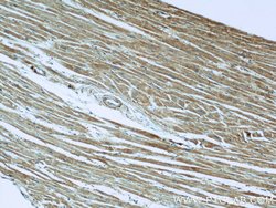 TRAPPC9 Rabbit anti-Human, Mouse, Rat, Zebrafish, Polyclonal, Proteintech:Anticorps:Anticorps