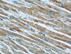 TRAPPC9 Rabbit anti-Human, Mouse, Rat, Zebrafish, Polyclonal, Proteintech:Anticorps:Anticorps