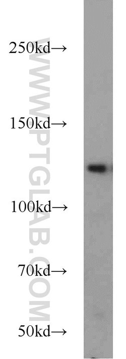 TRAPPC9 Rabbit anti-Human, Mouse, Rat, Zebrafish, Polyclonal, Proteintech:Anticorps:Anticorps