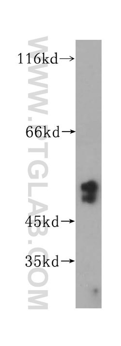 NAP1L4 Rabbit anti-Human, Mouse, Rat, Polyclonal, Proteintech:Antibodies:Primary