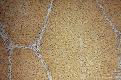 NAP1L4 Rabbit anti-Human, Mouse, Rat, Polyclonal, Proteintech:Antibodies:Primary