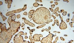 DBR1 Rabbit anti-Human, Mouse, Rat, Polyclonal, Proteintech:Anticorps:Anticorps