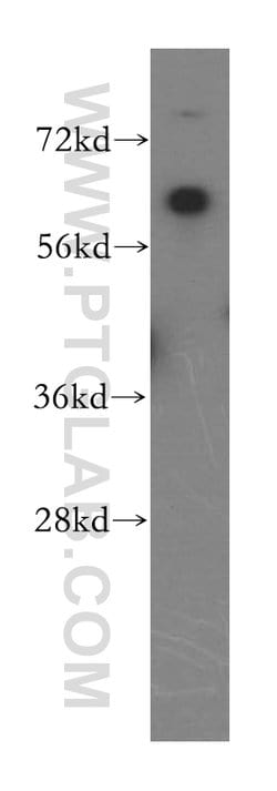 DBR1 Rabbit anti-Human, Mouse, Rat, Polyclonal, Proteintech:Anticorps:Anticorps