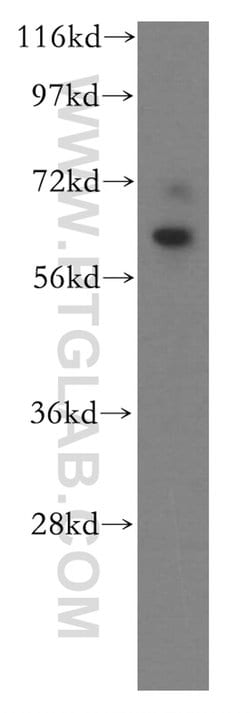 DBR1 Rabbit anti-Human, Mouse, Rat, Polyclonal, Proteintech:Anticorps:Anticorps