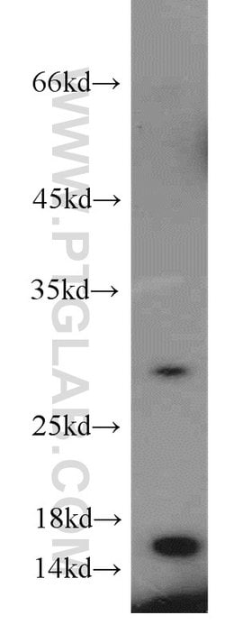 CST1 Rabbit anti-Human, Polyclonal, Proteintech:Antibodies:Primary Antibodies