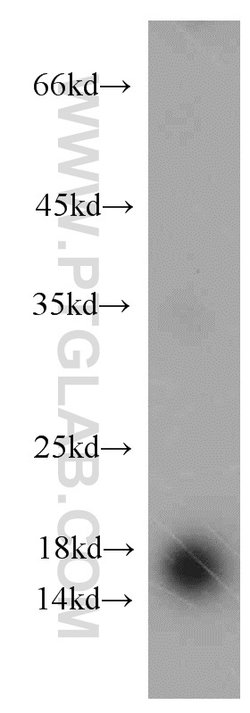 CST1 Rabbit anti-Human, Polyclonal, Proteintech:Antibodies:Primary Antibodies