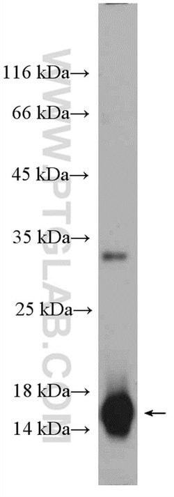 CST1 Rabbit anti-Human, Polyclonal, Proteintech:Antibodies:Primary Antibodies