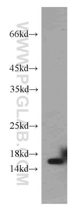 CST1 Rabbit anti-Human, Polyclonal, Proteintech:Antibodies:Primary Antibodies