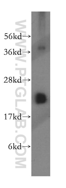 MRPS10 Rabbit anti-Human, Mouse, Rat, Polyclonal, Proteintech 150 &mu;L;