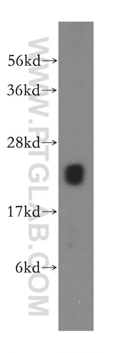 MRPS10 Rabbit anti-Human, Mouse, Rat, Polyclonal, Proteintech 150 &mu;L;