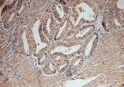 SERPINB2 Rabbit anti-Human, Polyclonal, Proteintech:Antibodies:Primary