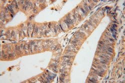 SERPINB2 Rabbit anti-Human, Polyclonal, Proteintech:Antibodies:Primary