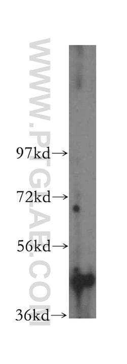 SERPINB2 Rabbit anti-Human, Polyclonal, Proteintech:Antibodies:Primary