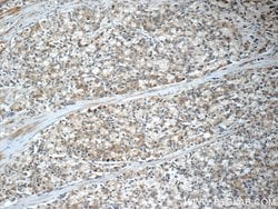C20orf195 Rabbit anti-Human, Mouse, Rat, Polyclonal, Proteintech 150 &mu;L;