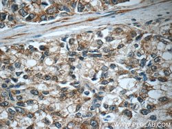 C20orf195 Rabbit anti-Human, Mouse, Rat, Polyclonal, Proteintech 150 &mu;L;