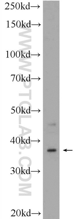 C20orf195 Rabbit anti-Human, Mouse, Rat, Polyclonal, Proteintech 150 &mu;L;