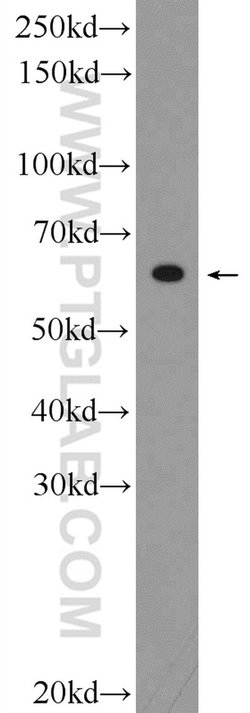 C20orf195 Rabbit anti-Human, Mouse, Rat, Polyclonal, Proteintech 150 &mu;L;