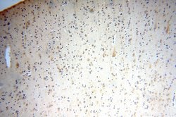 IFFO1 Rabbit anti-Human, Mouse, Rat, Polyclonal, Proteintech:Antibodies:Primary