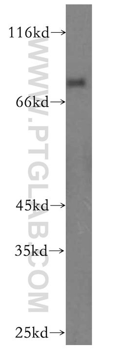 IFFO1 Rabbit anti-Human, Mouse, Rat, Polyclonal, Proteintech:Antibodies:Primary